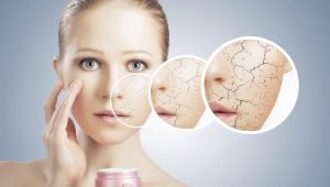 Ang mga subtleties ng pangangalaga para sa dry skin