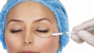 Ang proseso ng blepharoplasty na mas mababang eyelids