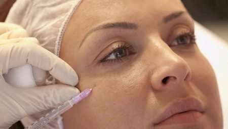 Mukha ng mesotherapy: ano ito at paano ito ginagawa?