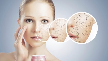 Ang mga subtleties ng pangangalaga para sa dry skin