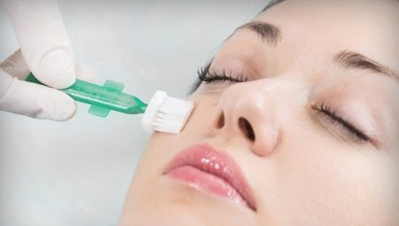 Chemical peeling: kailan at paano ito magagawa?