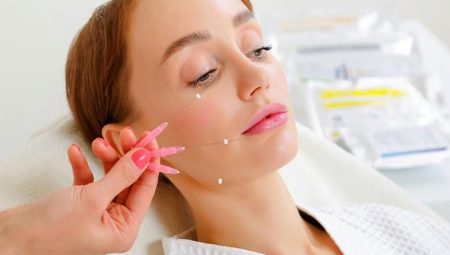 Mesothreads para sa facelift: mga tampok at panuntunan ng paggamit