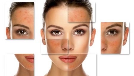 Salicylic peeling: mga tampok at mga patakaran ng application