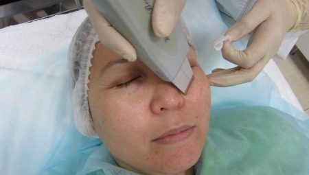 Panuntunan para sa ultrasonic cleaning ng mukha
