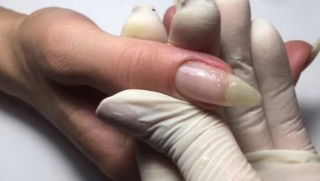 Features building a broken nail