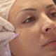 Mukha ng mesotherapy: ano ito at paano ito ginagawa?