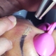 Ang mga detalye ng proseso ng laser eyebrow tattoo removal