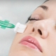 Chemical peeling: kailan at paano ito magagawa?