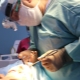 Mga tampok ng pamamaraan na endoscopic facelift