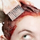 Allergy to hair dye